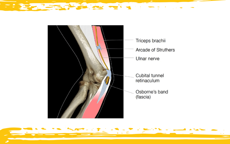 4. Diagnostico diferencial parte 1 ecografia tempo formacion.png